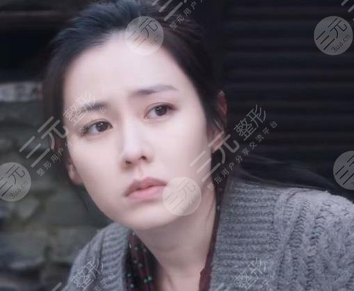 孙艺珍颜值有缺陷吗?