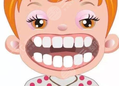 湘雅医院口腔科种植牙案例-重新get一口好牙！
