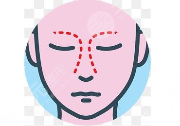 宝鸡人民医院整形美容科隆鼻案例分享