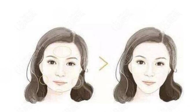 俞良钢磨骨案例
