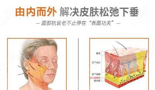 注射胶原蛋白