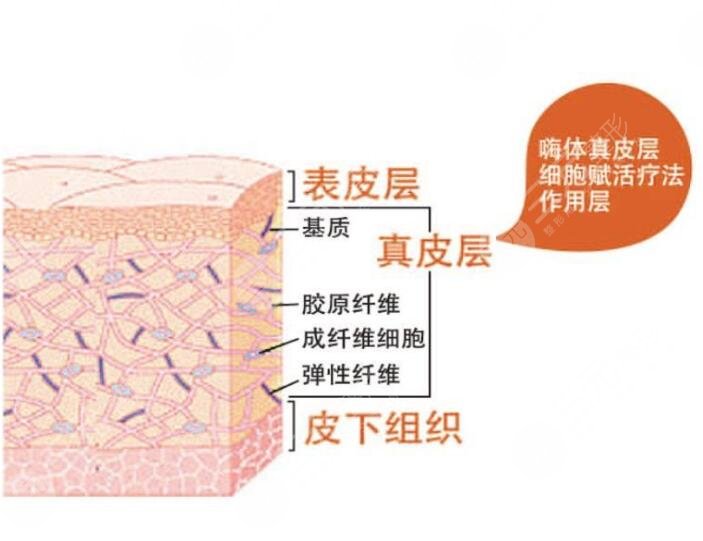 嗨体和注射除皱的区别是什么?
