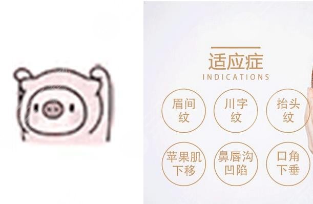 v美减龄果好不好能维持几年?