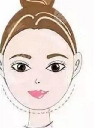 长沙人民医院整形美容科怎么样