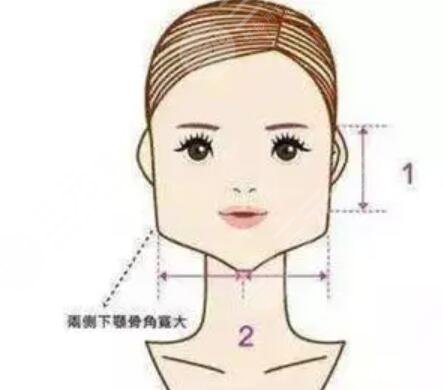 北京艺星整形医院磨下颌角整形多少钱?