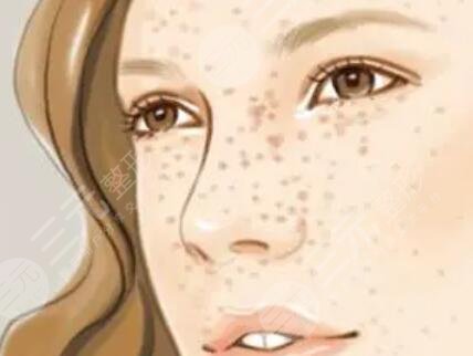 收藏！弋矶山美容科激光祛斑前后对比图，附全新价格表一览~