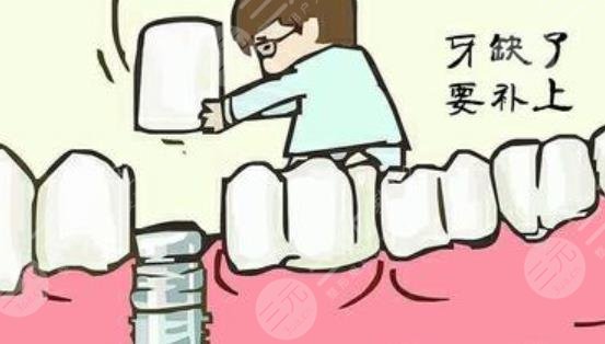 牙齿种植