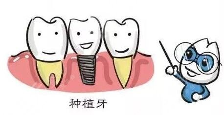 做种植牙对身体有哪些要求?