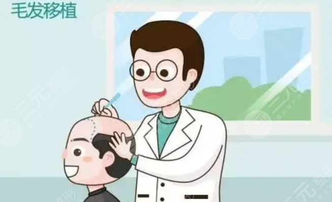 西安植发医生王禹技术好吗