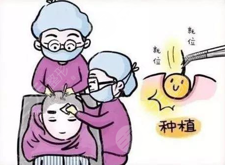 西安植发医生王禹技术好吗