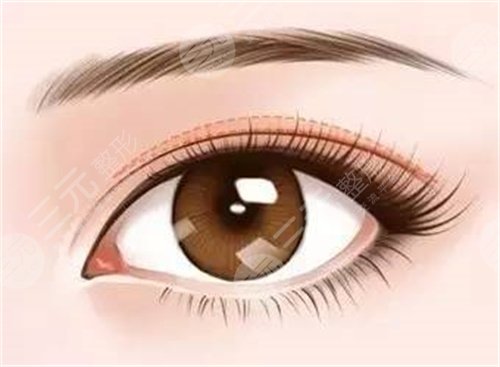 八大处宗宪磊技术好吗 做双眼皮案例图参考