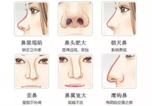 上海九院戴传昌做鼻子怎么样 有案例吗？