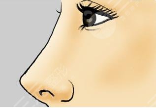 尹卫民做鼻子是什么风格？做鼻子价格