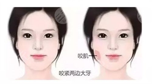 强势安利!宁波第六医院整形外科主任介绍+项目价格表~