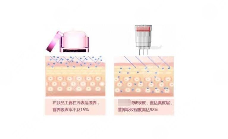 水光补水具体导入的是什么材料呢?