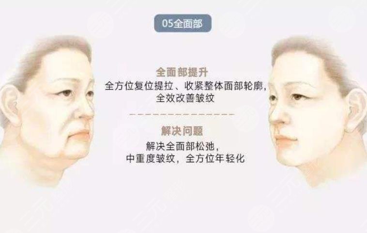 v美减龄术后的护理