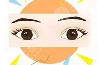 北京彤美刘风卓双眼皮案例