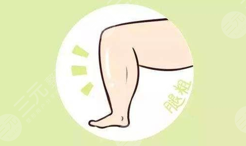 东方和谐冯斌医生小腿吸脂案例