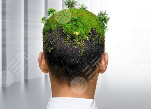 东莞美立方植发医院植发手术经历分享