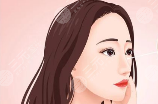 昆山达拉斯刘波隆鼻案例 术前