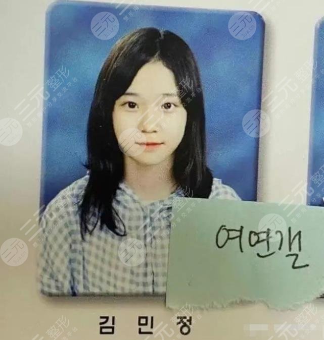 金玟庭winter陷整容风波,她动了哪里?