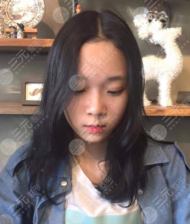 金玟庭winter陷整容风波,她动了哪里?