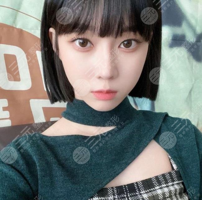 金玟庭winter陷整容风波,她动了哪里?