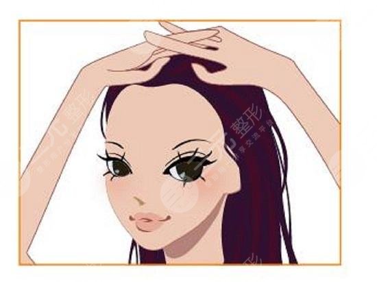 北京中德植发医院发际线改良植发经历分享