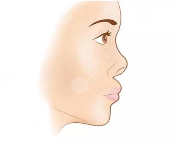 雅涵高山做鼻子怎么样