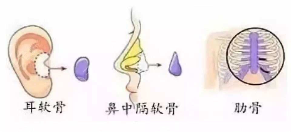 雅涵高山做鼻子怎么样