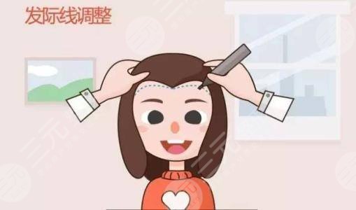 济南雍禾医院大面积植发缓解经历分享
