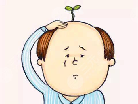 温州大麦微针植发医院脱发种植经历分享