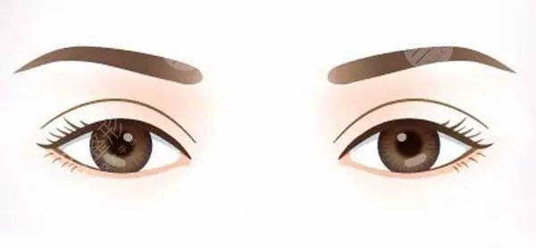 双眼皮整形手术之后果