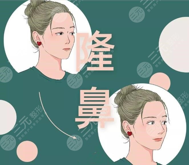 膨体隆鼻+肋骨隆鼻是*的吗?