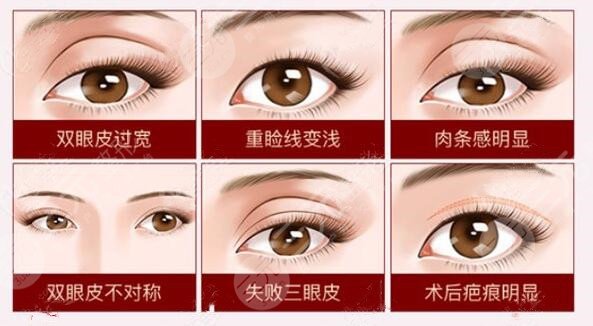 国内眼修复项目科普