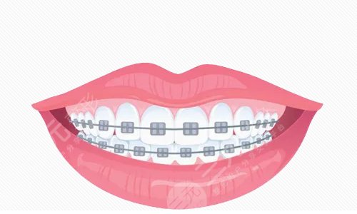 上海九院牙科擅长项目: