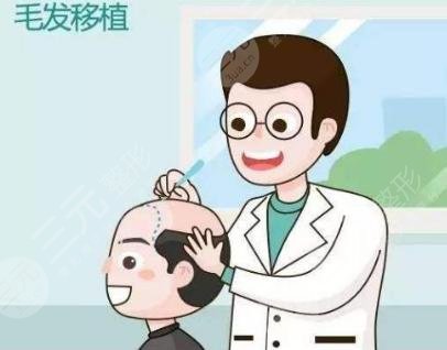 宁波摩范植发医院发际线植发经历分享
