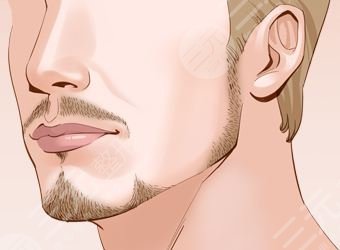 乌鲁木齐雍禾植发医院胡须种植经历分