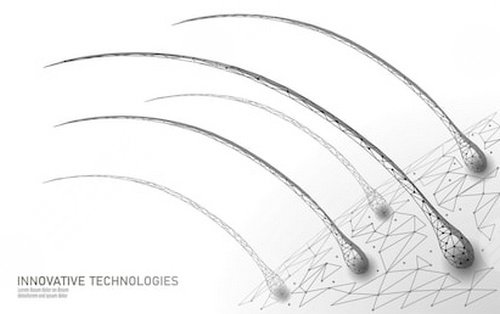 广州碧莲盛植发医院头顶加密植发案例分享
