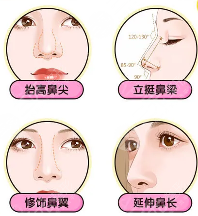 上海星氧陈建医生隆鼻案例手术当天