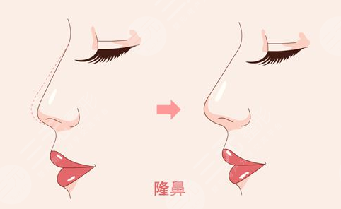 武汉肋骨鼻刘波