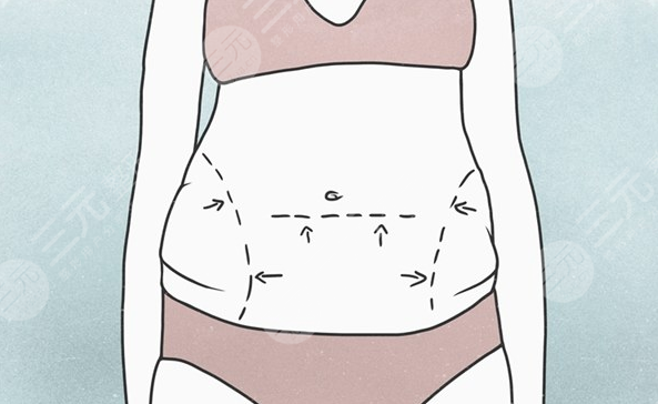 千美杜鹏医生吸脂整形前