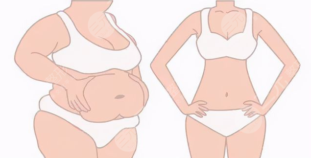 千美杜鹏医生吸脂整形后护理