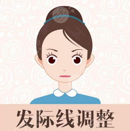 东莞美立方植发中心发际线种植分享