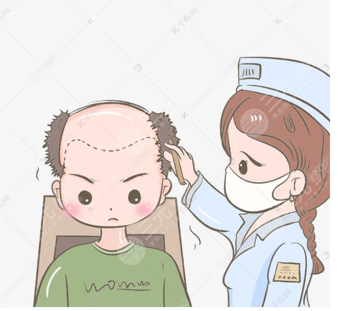 上海九院植发刘清医生案例分享