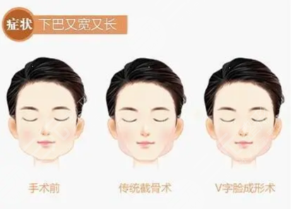 北京圣嘉荣医院黄大勇