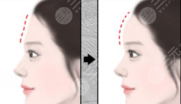 杭州艺星蒋铮铮