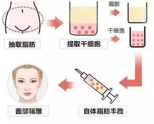 杭州艺星蒋铮铮