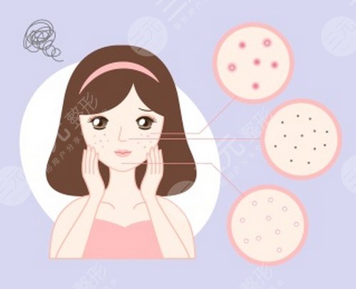 李大铁祛斑好吗?