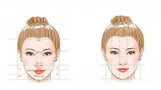 刘先超做颧骨内推术后3天